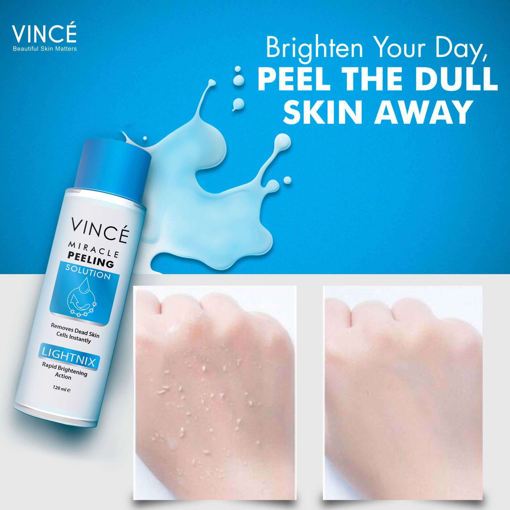 Vince Lightnix Miracle Peeling Solution 120ml