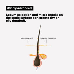 L'Oreal Professionnel Serie Expert Scalp Dandruff Advance Shampoo (300ml)