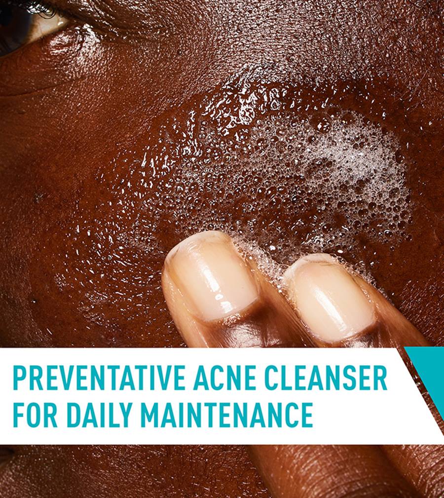 CeraVe Acne Control Cleanser (237ml)