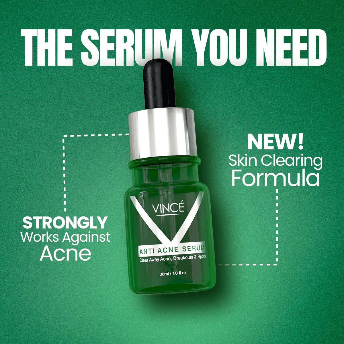Vince Anti Acne Serum  30ml
